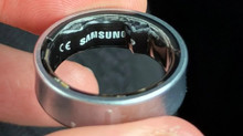 Samsung Galaxy Ring battery swelled on user's finger — had to be removed in hospital