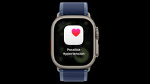 Apple receives regulatory approval for hypertension detection feature in Apple Watch