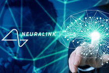 Компанія Ілона Маска Neuralink готує клінічні випробування імплантатів мозку на людях