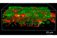 In the USA, a brain tissue that can develop like a real one has been printed on a 3D printer