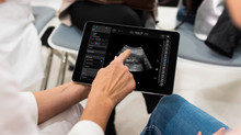 Samsung plans to invest in Exo, a startup that creates portable medical ultrasound devices