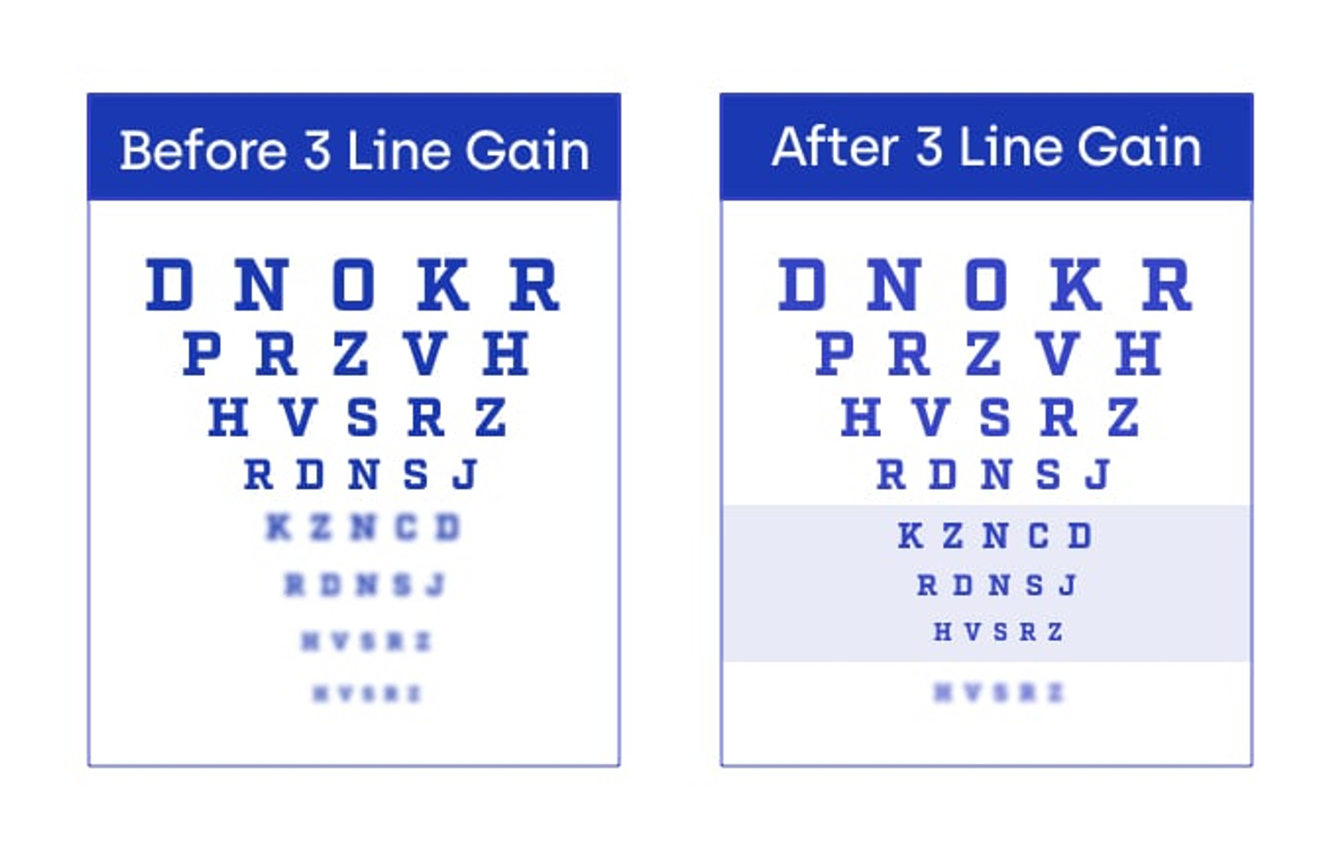 vuity vision eye chart